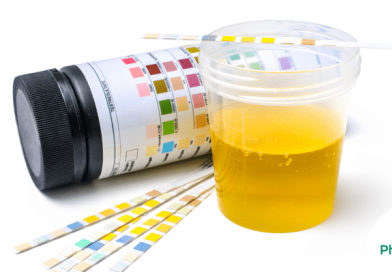 Mode of action of urine therapy or urine fast